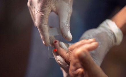 SUS começa a usar novo tratamento contra a malária em crianças