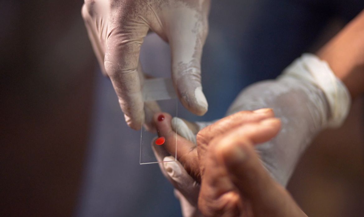 SUS começa a usar novo tratamento contra a malária em crianças